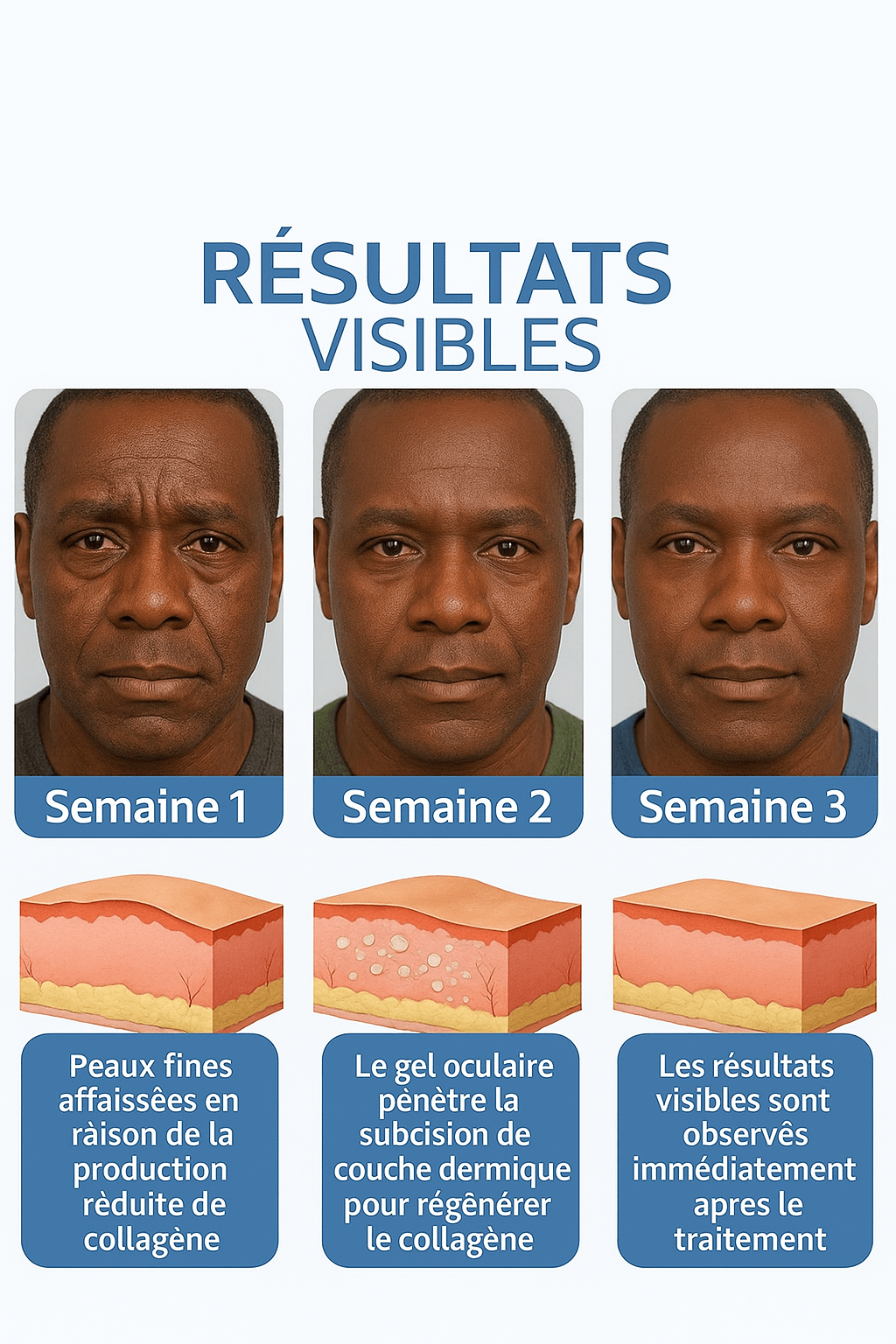 Crème Anti âge ( Rides et Cerne)