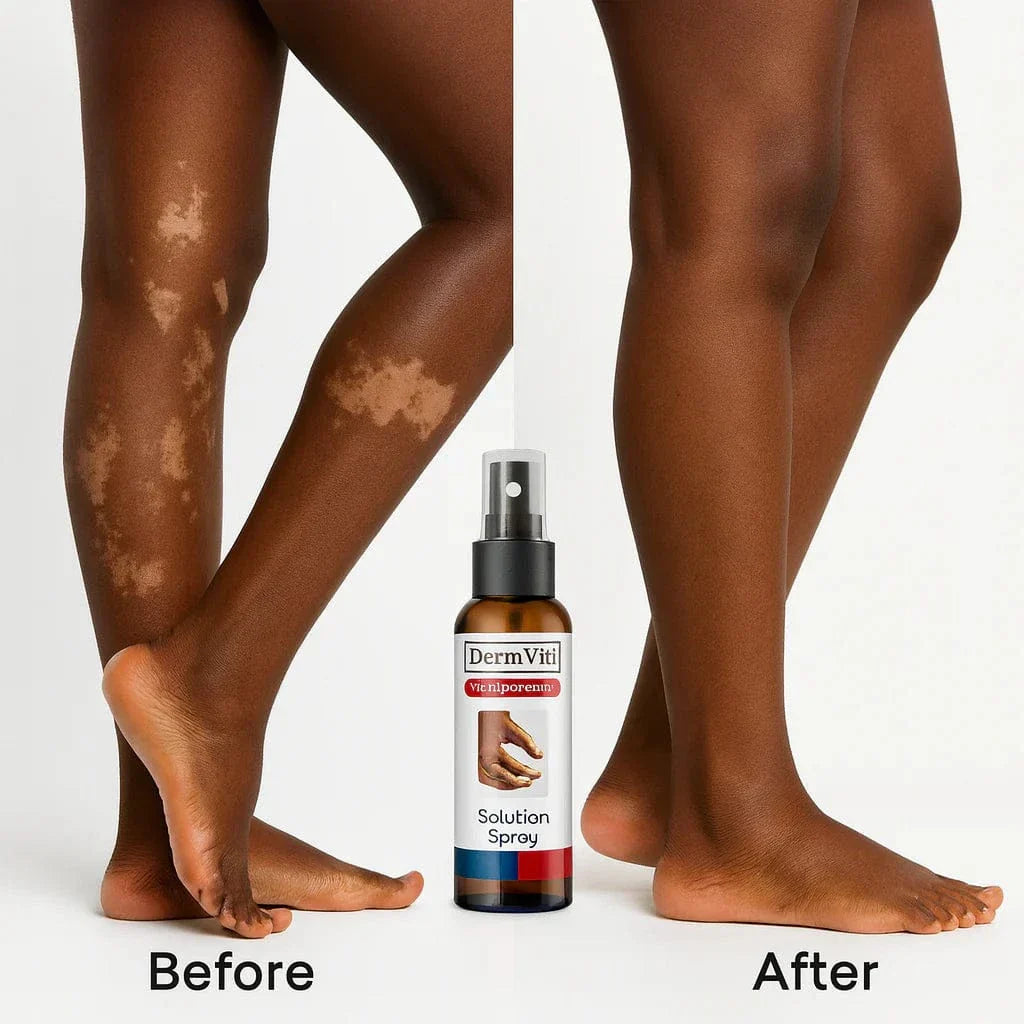 Spray Solution Réparatrice de la Peau Vitiligo