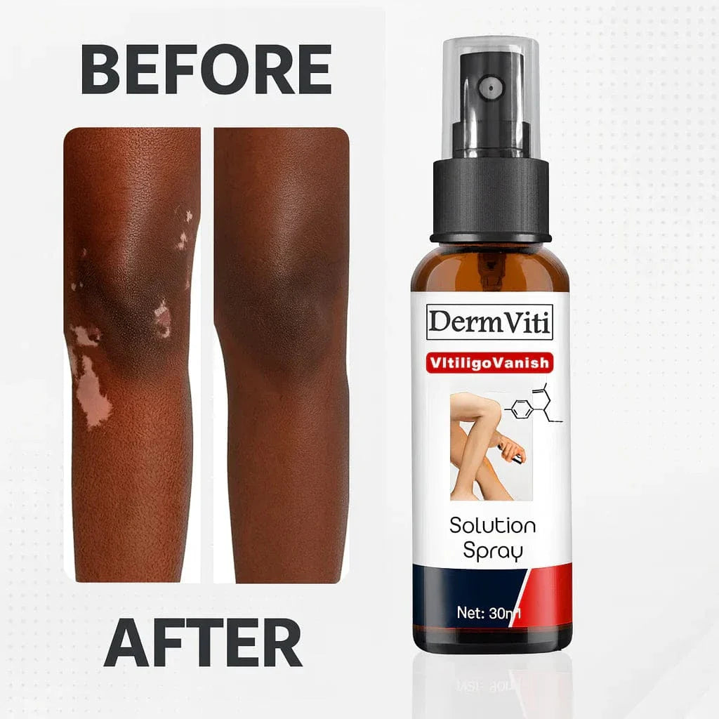 Spray Solution Réparatrice de la Peau Vitiligo