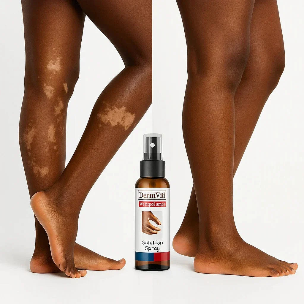Spray Solution Réparatrice de la Peau Vitiligo
